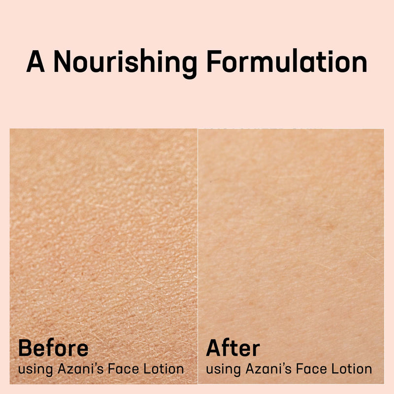 Before and After-Face Lotion