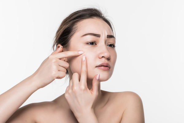 Salicylic Acid vs. Benzoyl Peroxide: Which Is a Better acne-clearing ingredient?