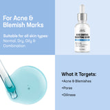 What it targets-Acne Control Clarifying Serum
