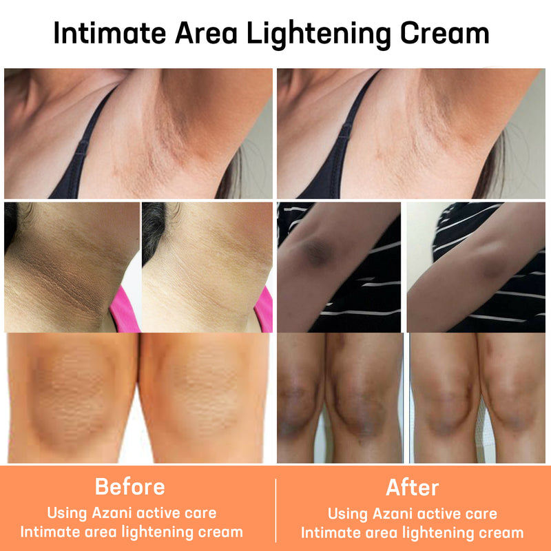 Before and After-Intimate Area Lightening Cream