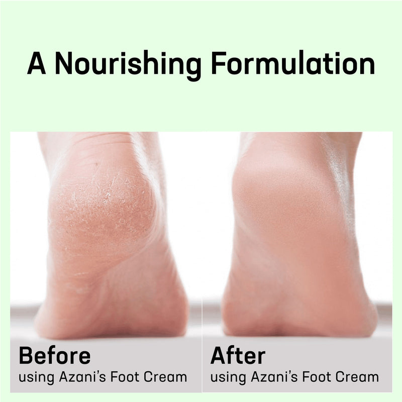 Before and After-Foot Cream