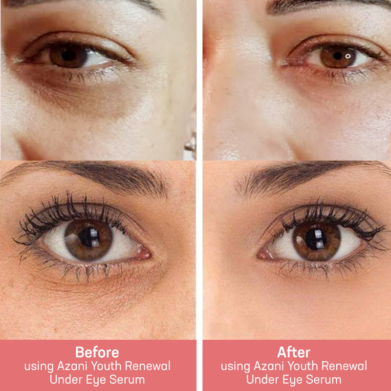 Before and After-Youth Renewal Under Eye Serum