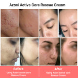 Before & After-Rescue Cream
