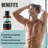 Benefits-Anti Dandruff Shampoo
