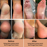 Anti Fungal Foot Cream